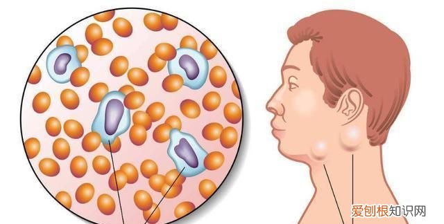 有肿块就是肿瘤吗