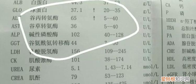 谷丙转氨酶是什么,转氨酶活力单位数计算公式