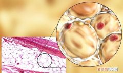 震動甩脂機真的能減掉脂肪嗎，震動甩脂機真的能減肥