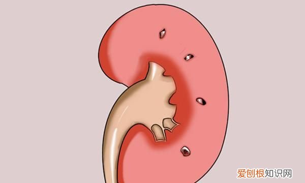 得肿瘤身体会有肿块吗,体内的一切肿块都属于肿瘤吗