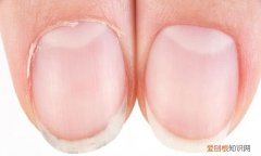 健康问题的10 种指甲迹象,健康问题的 10 种指甲迹象