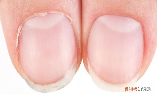 健康问题的10 种指甲迹象,健康问题的 10 种指甲迹象