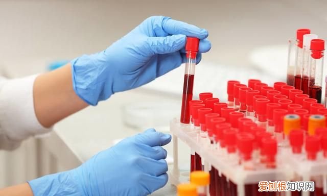 健康问题的10 种指甲迹象,健康问题的 10 种指甲迹象