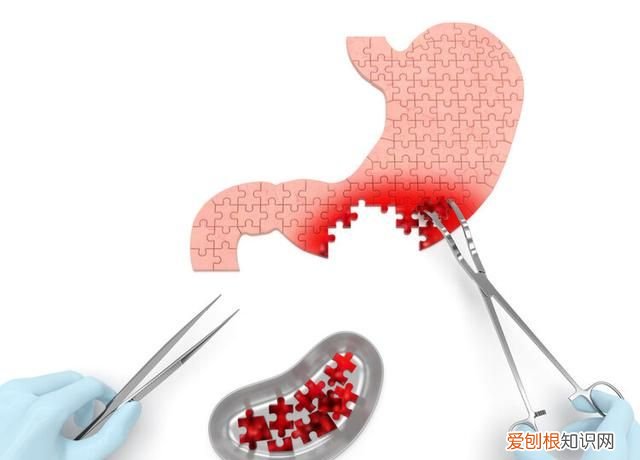 癌症不会传染但是四种癌症要小心,早期癌症为什么不会转移