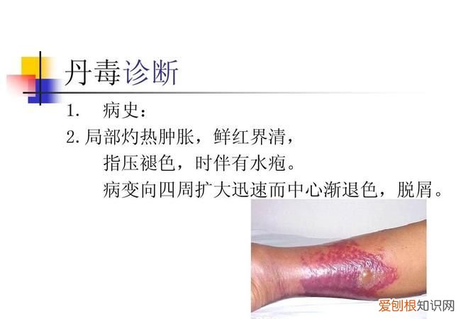 疽怎么读，寻常疣怎么读的请帮忙回？
