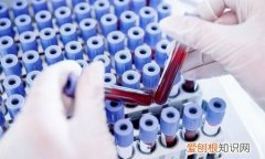 什么是现代工业的血液