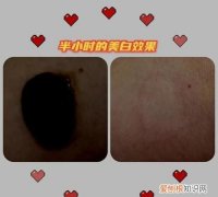 著手成春的意思，俱道适往著手成春的意思