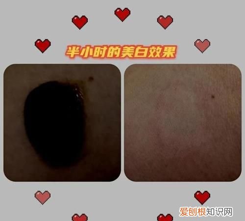 著手成春的意思,俱道适往著手成春的意思