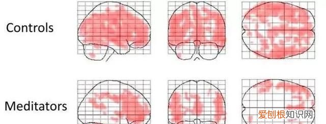 每天冥想几分钟,将改变你的生活状态