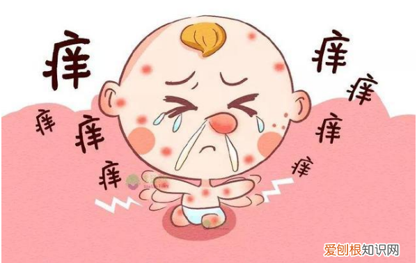 小儿过敏有哪些临床表现 小儿皮肤过敏