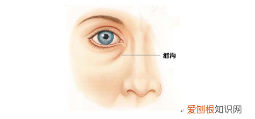 什么是泪沟？ 泪沟是什么！