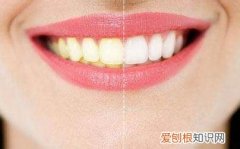 牙齿变黄的五大原因 牙齿黄是什么原因