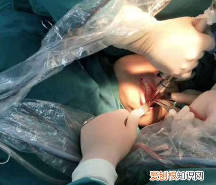 神秘的“磨骨”手术 削骨手术过程是怎样的