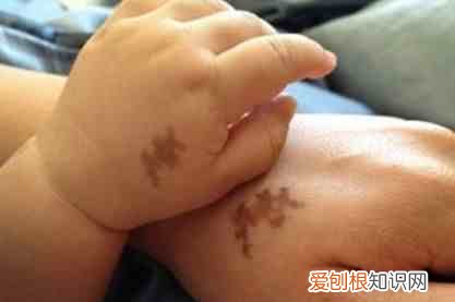 身上的胎记是怎样形成的 胎记是怎么得的