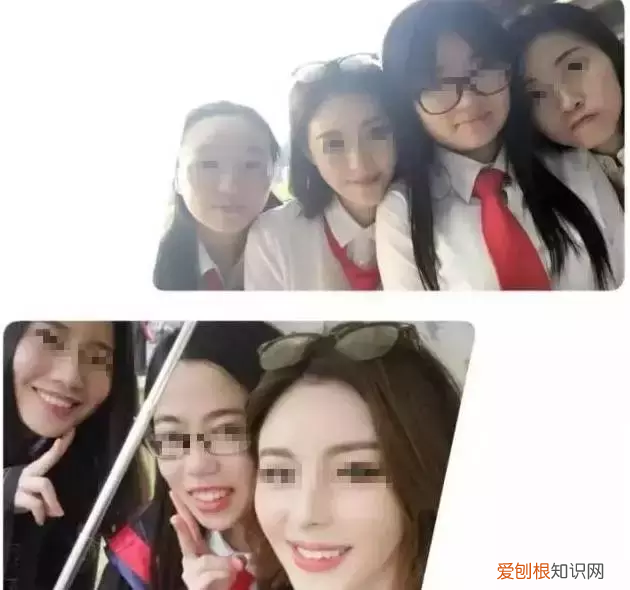 牙齿矫正对颜值有多大影响 牙齿矫正图