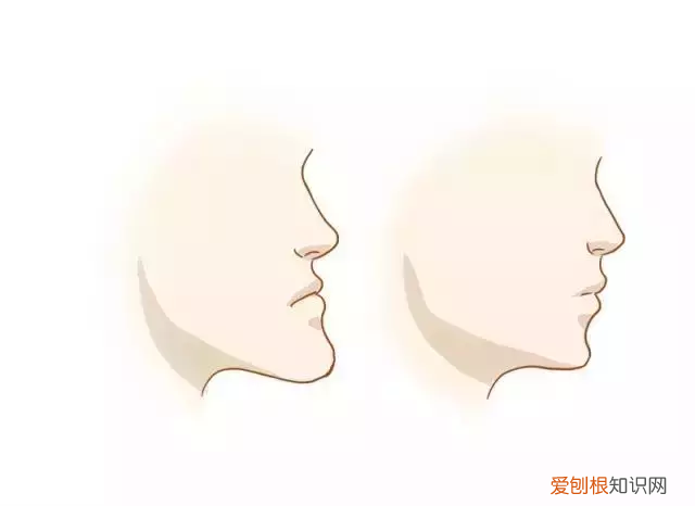 牙齿矫正对颜值有多大影响 牙齿矫正图