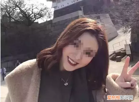 牙齿矫正对颜值有多大影响 牙齿矫正图