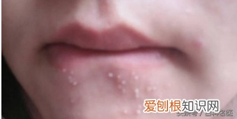 嘴巴周围为啥老长痘痘？ 嘴巴周围长痘痘是什么原因
