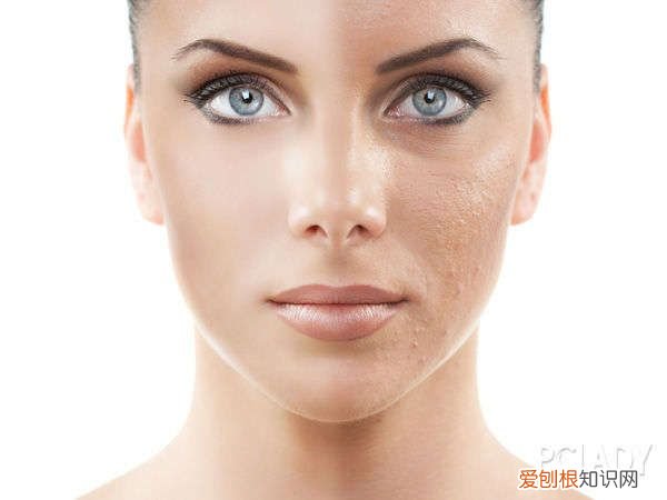 打瘦脸针须知的注意事项 打完瘦脸针要注意什么东西