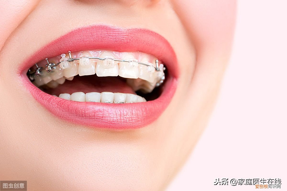 牙齿矫正后，这4件事做好了 矫正后的牙齿