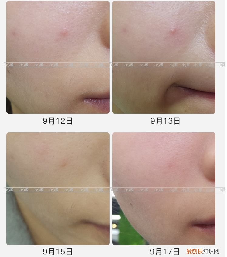 用好LED美容仪堪比10级美颜 光疗美容仪有效果吗