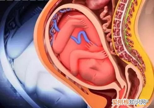 胎盘钙化怎么回事 胎儿钙化