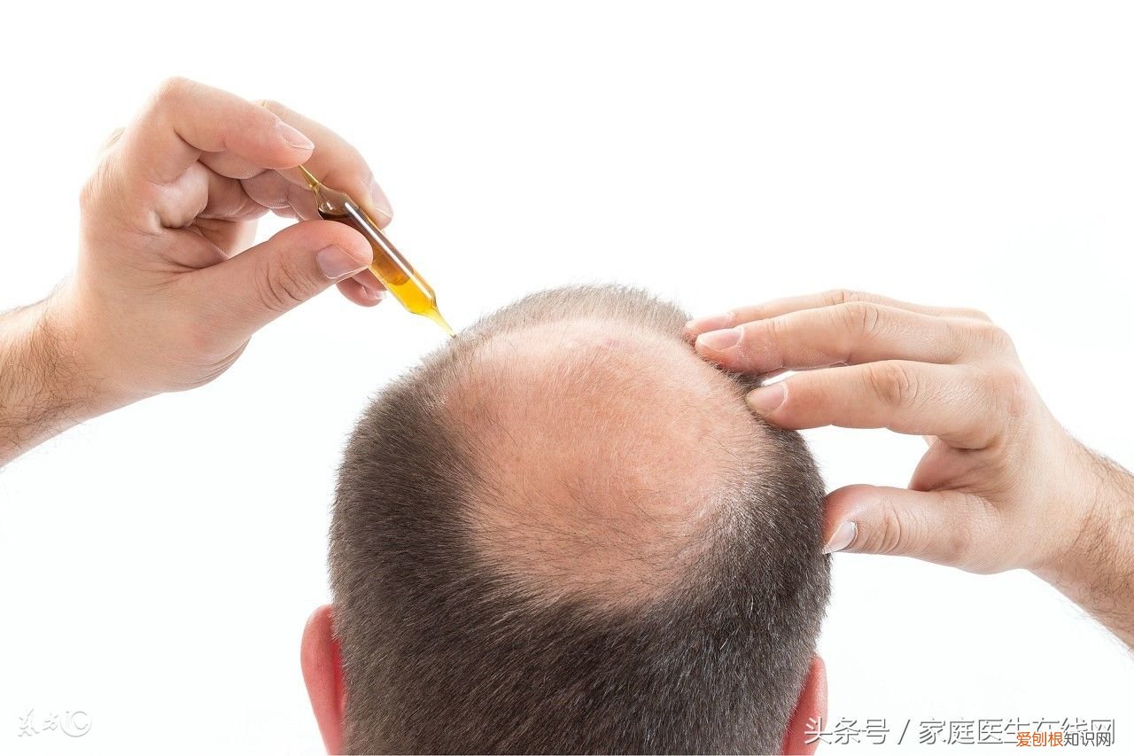 掉发严重是身体哪里出毛病了? 头发掉的厉害是