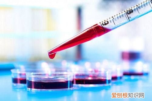 早孕试纸怎么使用？ 试纸怎么看