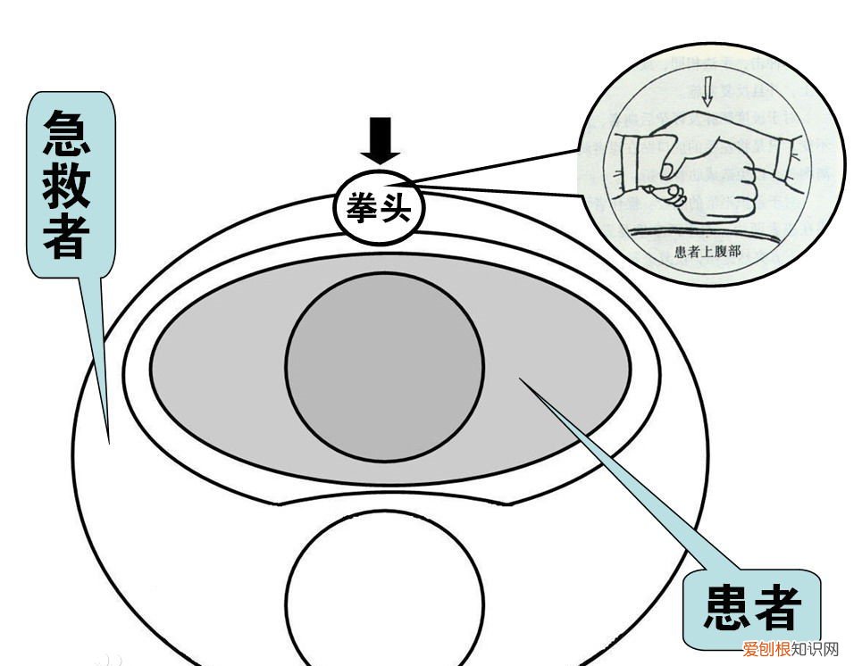 什么是海姆立克急救法？附：海姆立克急救法的详细步骤