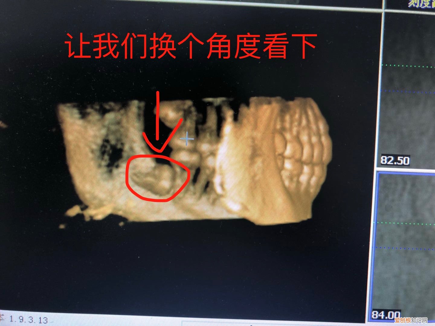 长智齿应是大吉之意 有人说长智齿是吉兆