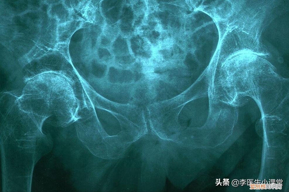 引起腿抽筋的5种原因 腿抽筋是什么原因如何解决