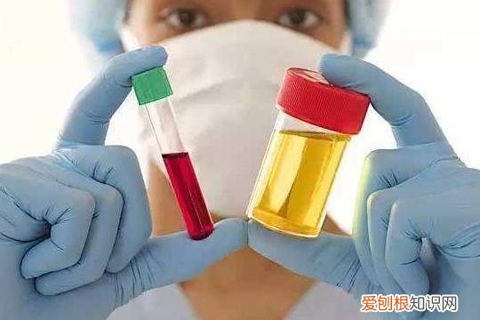 这几种食物是高尿酸克星 尿酸高吃什么最好最降得快