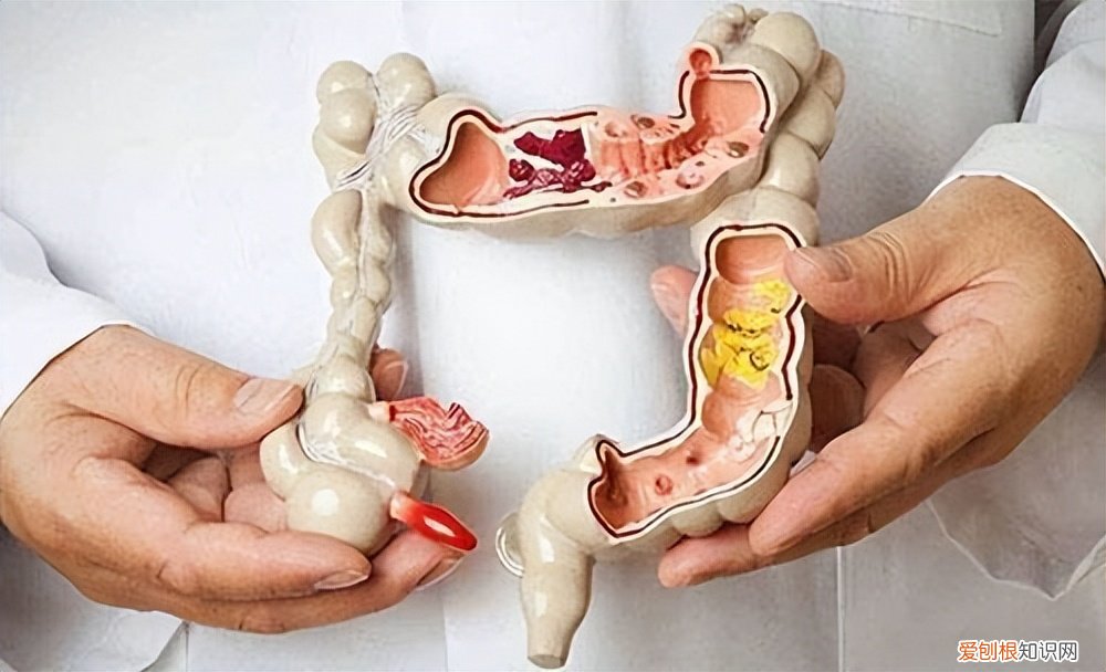 附：朱迅身体最新情况2022详细介绍 朱迅最近身体怎么样？