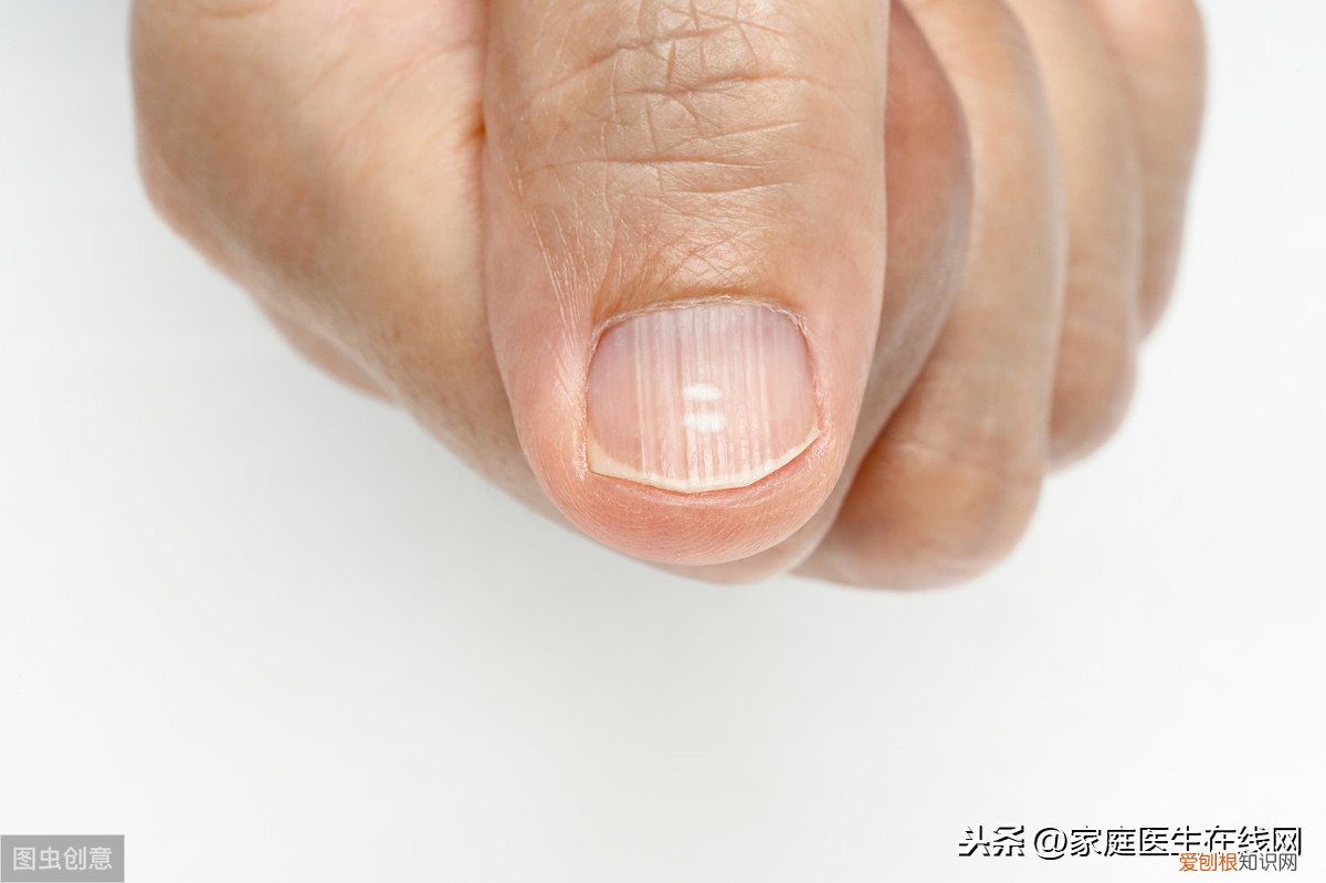 指甲有竖纹什么原因？总结6个原因，都要重视