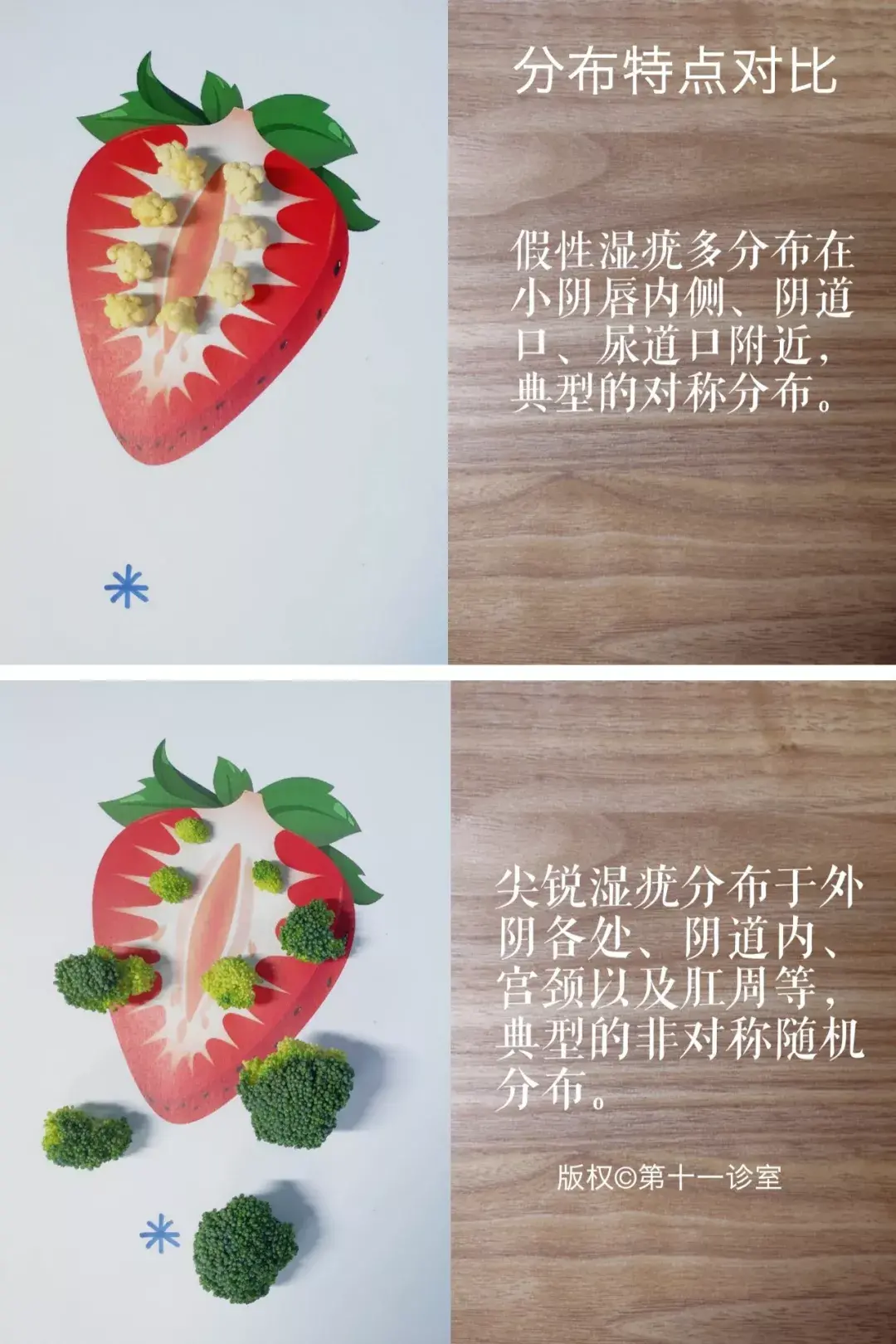 尖锐湿疣是什么样的,尖锐湿疣图片真实