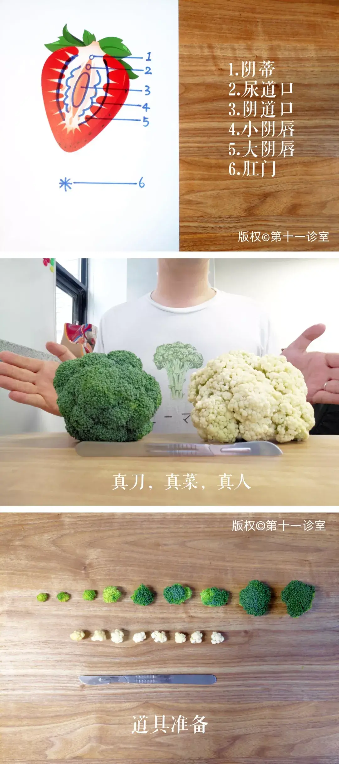 尖锐湿疣是什么样的,尖锐湿疣图片真实