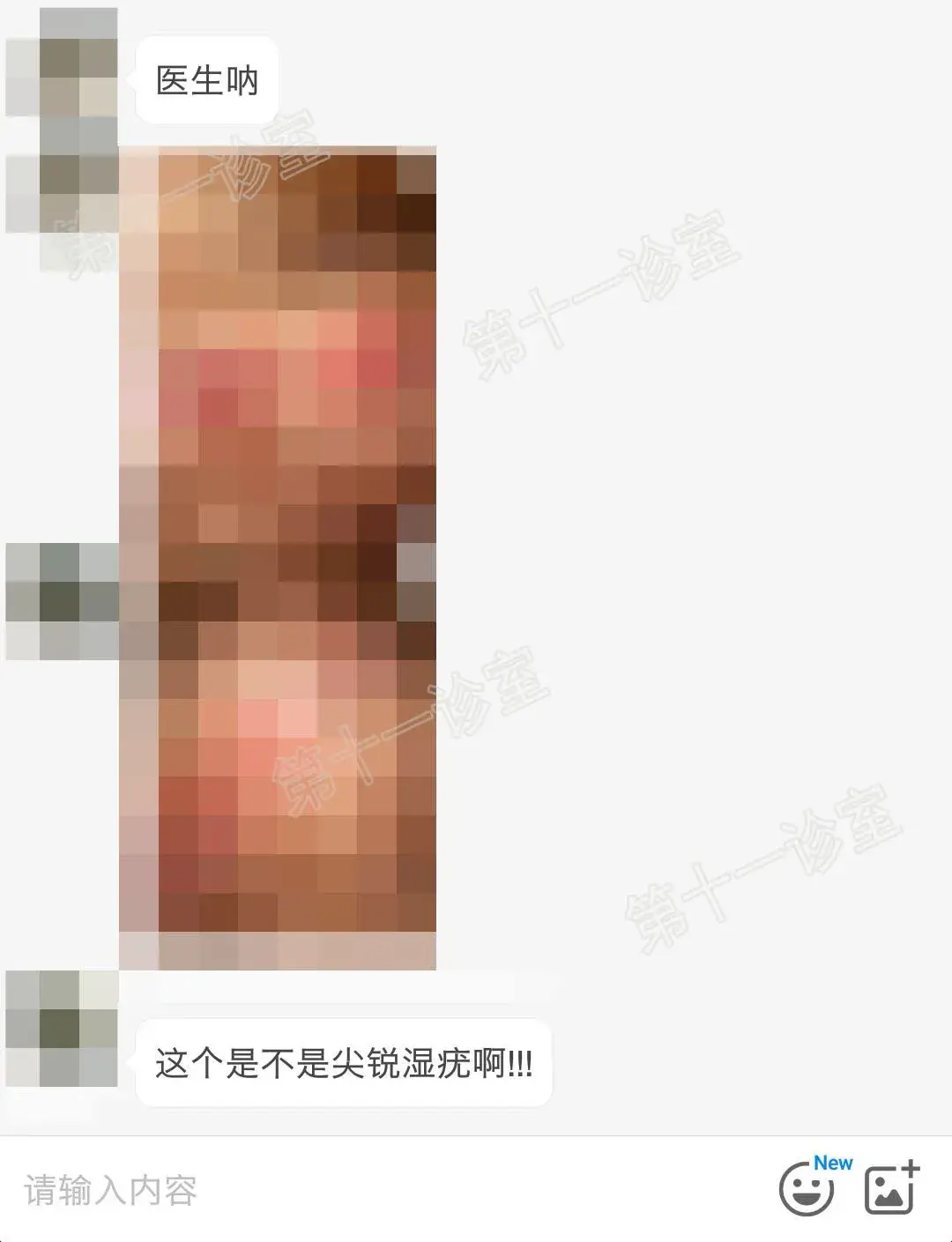 尖锐湿疣是什么样的,尖锐湿疣图片真实