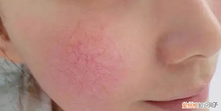 柔肤水和爽肤水的区别及适用肤质 柔肤水和爽肤水的区别