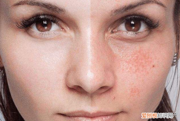 柔肤水和爽肤水的区别及适用肤质 柔肤水和爽肤水的区别