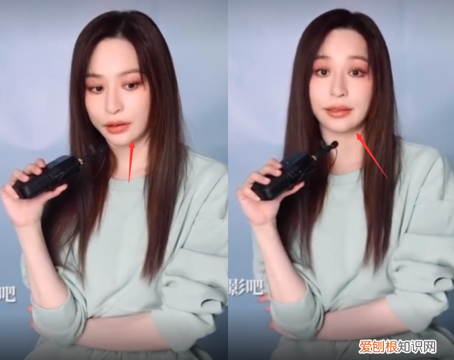 王心凌脸恢复了吗?下巴凹陷嘴巴厚重,模样大变差点没认出