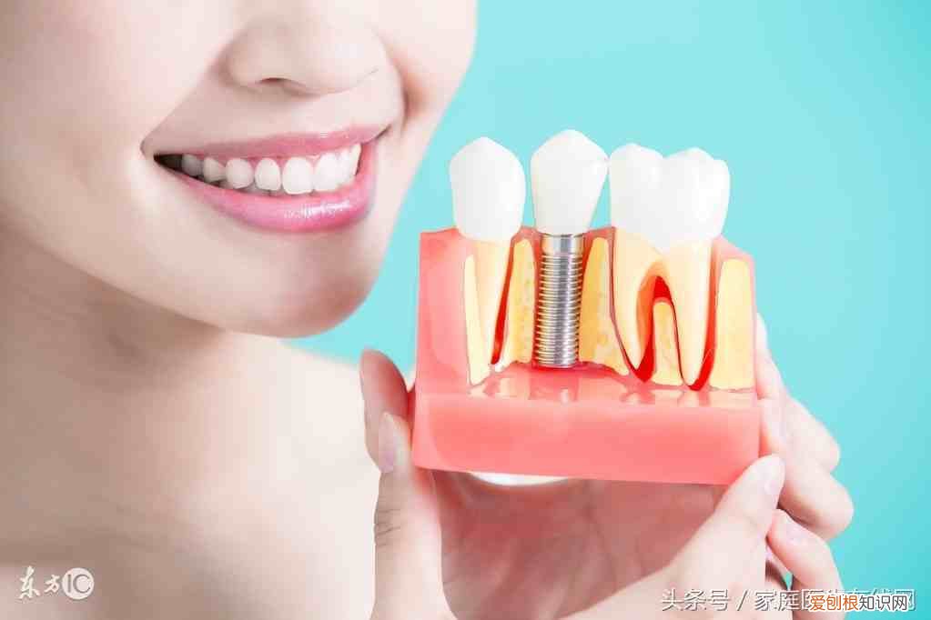 种植牙能用一辈子吗？ 种植牙多少钱一颗
