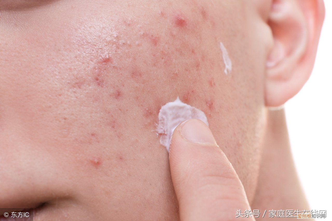 3招助你“消灭”螨虫 螨虫最怕这3种东西