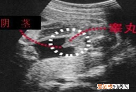 四维照片一看就是男孩 b超有两点基本是男孩