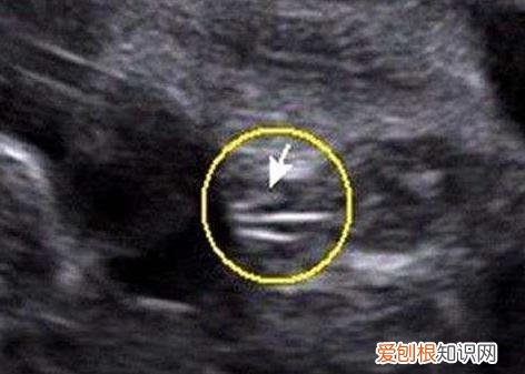 四维照片一看就是男孩 b超有两点基本是男孩