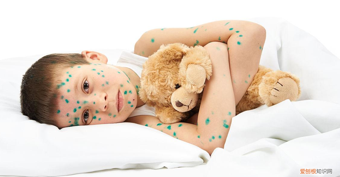 让全球记忆深刻的六大传染病，天花环球航行，霍乱首次在印度现身