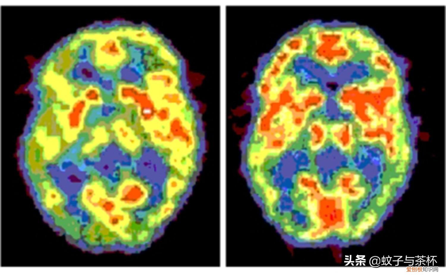 人为什么会做梦呢答案是什么 人为什么会做梦