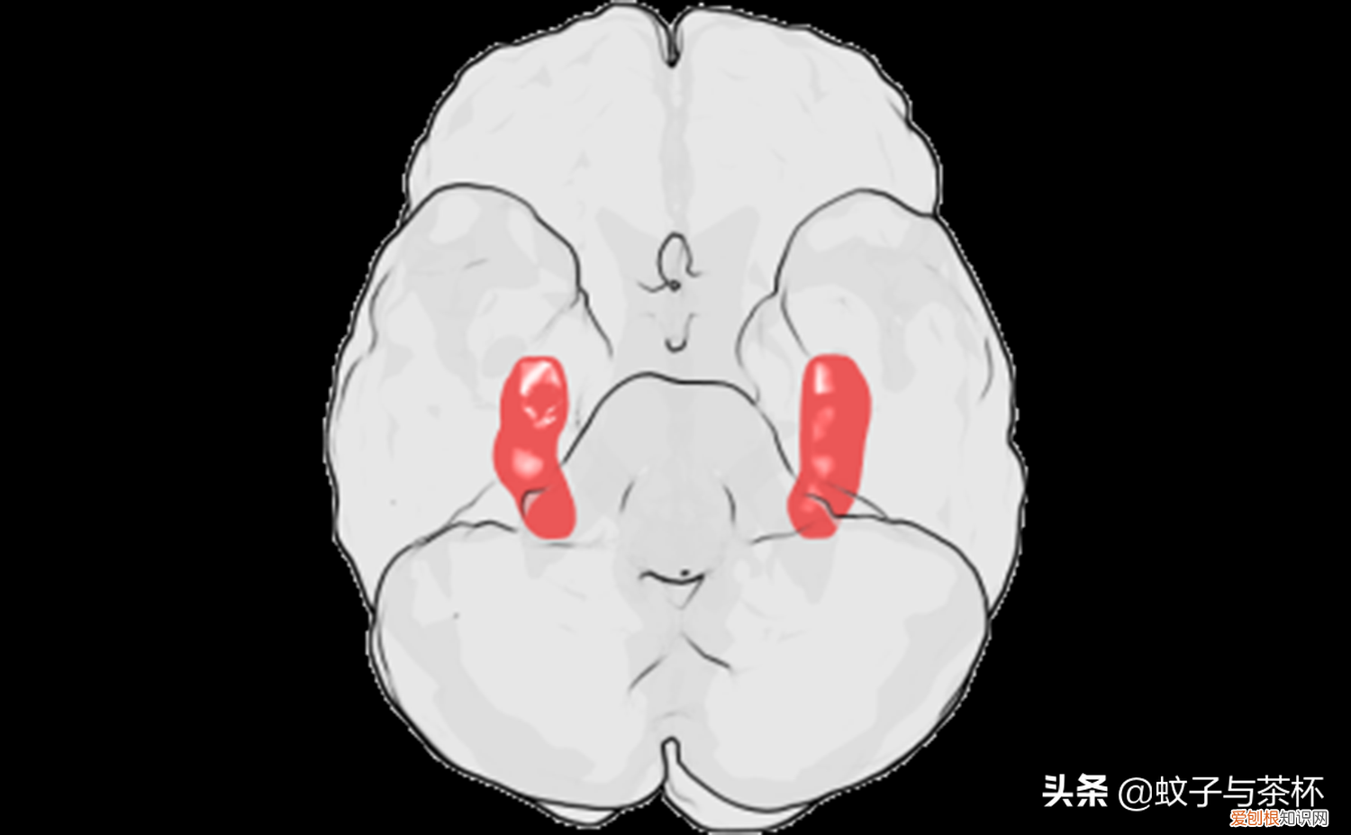 人为什么会做梦呢答案是什么 人为什么会做梦