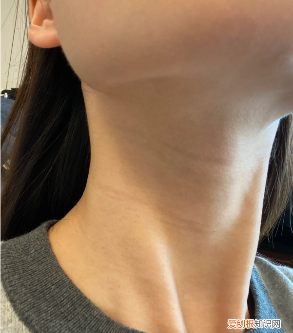 如何去除颈纹最有效 如何有效去除颈纹