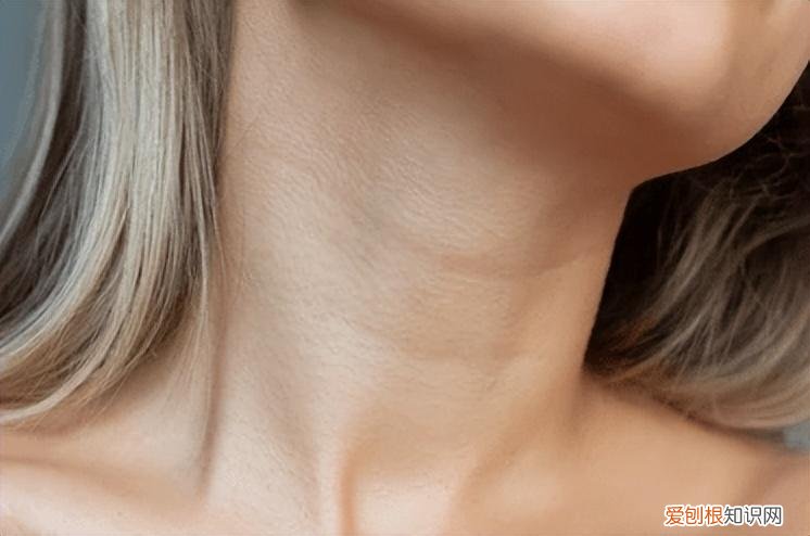 如何去除颈纹最有效 如何有效去除颈纹