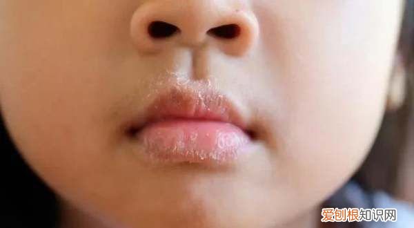 为什么嘴唇会脱皮 嘴唇脱皮的原因